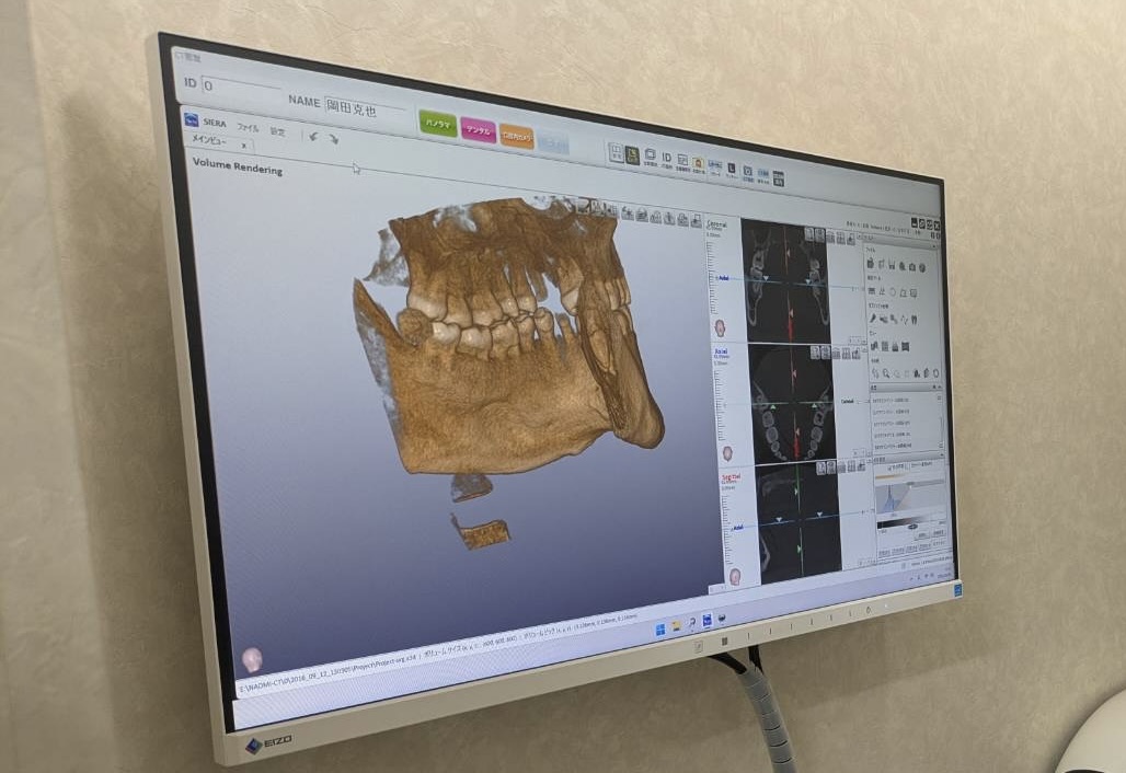 歯科用CT